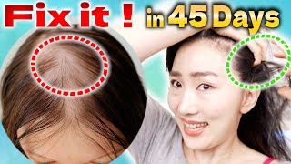 Scalp Lymphatic Drainage Massage to Improve Thinning Hair in 45 Days [upl. by Tekla]