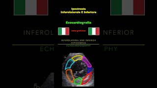 Ecocardiografia  Ipocinesia Inferolaterale E Inferiore [upl. by Wilder]