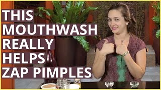 HOW TO USE LISTERINE MOUTHWASH FOR PIMPLES amp ACNE [upl. by Aivull]