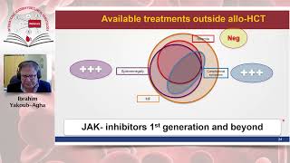 Allogeneic Stem Cell Transplantation for Myelofibrosis [upl. by Ut]