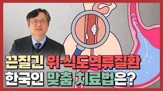 역류성식도염 치료 꼭 약을 장기간 복용해야 하나요 [upl. by Nwahsit123]