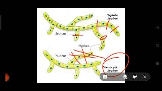 Septate hyphaeCoenocytic hyphaeneetbiologylifesxienceneet [upl. by Moht]