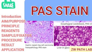 PAS STAIN  Histopathology Staining  histopathology [upl. by Aural636]