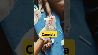 Cannula medico neetmotivation bscnursing youtubeshorts viral medicalcollegelife mbbs pw [upl. by Notwen421]