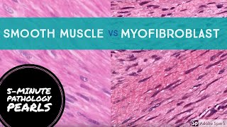 Myofibroblasts vs Smooth Muscle Made Easy 5Minute Pathology Pearls [upl. by Noemys]