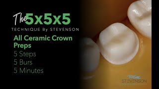 All Ceramic Crown Prep in 5 Minutes The 5x5x5 Technique [upl. by Perrine]