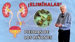 ¿Cómo EVITAR la formación y reaparición de CÁLCULOS RENALES  LITIASIS RENAL🪨 [upl. by Herzen]