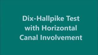 DixHallpike Test with Horizontal Canal Involvement [upl. by Malik707]