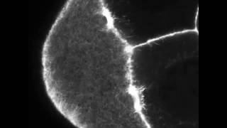 Cytoplasmic Streaming in the Drosophila Oocyte Video 5 [upl. by Savart]