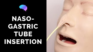 Nasogastric NG Tube Insertion  OSCE Guide  UKMLA  CPSA [upl. by Charlton]