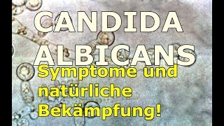 CANDIDA ALBICANS Symptome und Selbstbehandlung [upl. by Anu]