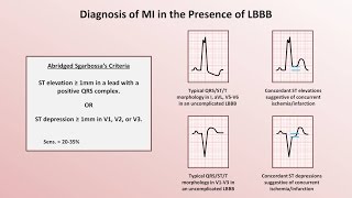 Intro to EKG Interpretation  Myocardial Infarctions Part 2 of 2 [upl. by Dlorrej]