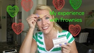 My experience with Frownies with before and after photo  BEAUTY OVER 40 [upl. by Meraree]