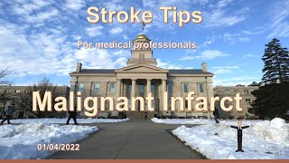 Stroke Tips Malignant Hemisphere infarct [upl. by Aicatan]