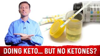 In Ketosis But No Ketones In Urine – Dr Berg [upl. by Llenyl]