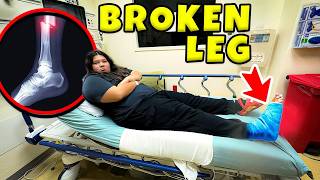 MY SISTER BROKE MY LEG 😡🏥 [upl. by Wilfreda646]