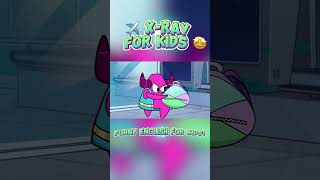 ✈️ Xray for Kids🤩 Funny English for Kids animation funny [upl. by Sherlock334]