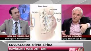 Çocuklarda Spina Bifida  Önce Çocuğum 22 Mart 2013 [upl. by Beatrisa]