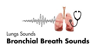 Bronchial Breath Sounds  Lung Sounds  Medzcool [upl. by Lionello]