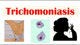 Trichomoniasis Common STI  Causes Symptoms amp Complications Cancer Diagnosis Treatment [upl. by Naic]