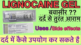 Lignocaine hydrochloride jelly  Xylocaine jelly  Uses Side effects  Lox 2 jelly Medicine [upl. by Nogras]