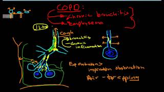 Pathophysiology of COPD [upl. by Dnamra]