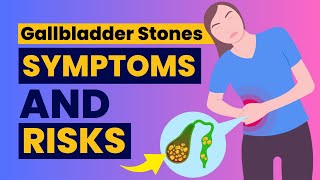 Gallbladder Stones Symptoms  Risk Factors and Complications  Cholelithiasis [upl. by Nnahaid]