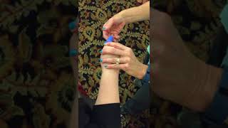 Serial Splinting for Finger Contractures [upl. by Goldin194]