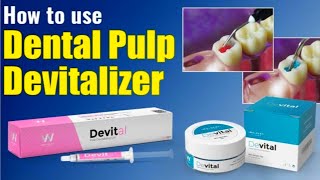 How to use Dental Pulp DevitalizerUses of Pulp Devitalizer pasteUnboxingDental Bharat [upl. by Nuahc894]