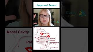 Do You Have Hyponasal Speech [upl. by Hallett]