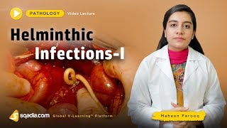 Helminthic Infections  Pathology Course  Medical Education  VLearning  sqadiacom [upl. by Assirram]