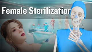 Female Sterilization Tubal Ligation Procedure  Tubectomy 3D Animation [upl. by Belshin]