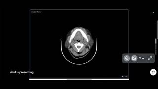 head n neck imaging mahavir cancer sansthan [upl. by Lougheed]