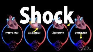 Shock Pathology of Different Types Animation [upl. by Egedan]