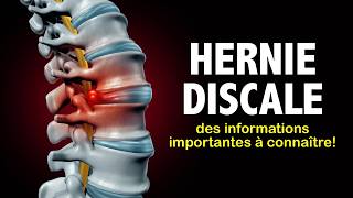 Hernie discale des informations importantes à connaître [upl. by Kcorb190]