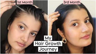 My 3 Months Experience of Using the Advanced Hair Growth serum [upl. by Sharia181]