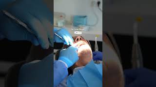 Cas de pose d’implants à Art’s clinic réalisé par Dr M Tajmouati [upl. by Arotahs]