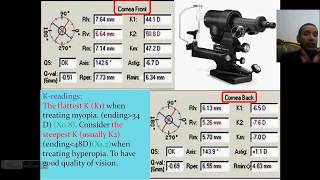 لأطباء العيون Pentacam1 [upl. by Burner72]