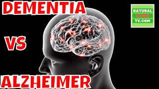 What Are The Differences Between DEMENTIA and ALZHEIMERS Disease [upl. by Elatnahc]