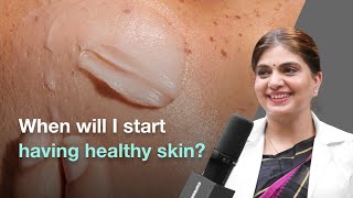 How Long Does It Take to See Healthy Skin  Cureskin [upl. by Soloma]