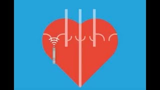 Abnormal Heart Rhythms Arrhythmia [upl. by Leinad]