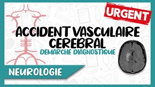 Accident Vasculaire Cérébral  Facteurs de Risque Diagnostic Clinique amp Paraclinique [upl. by Arammahs]