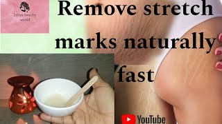 stretch mark removal homemade natural cream  natural ingredients  Skin care [upl. by Odrude]