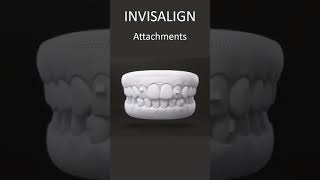 Invisalign Attachments  How They Work  London UK [upl. by Anaehs572]