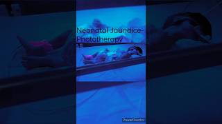 Neonatal Jaundice Phototherapy [upl. by Wilona461]