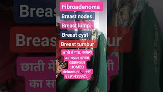 fibroadenoma [upl. by Ahsel]