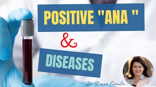 Positive ANA test antinuclear antibodies and autoimmune diseases [upl. by Jonny]