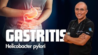 ¿Son sintomas de Gastritis o Bacteria Helicobacter Pylori [upl. by Ajay551]