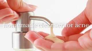 DIY Face Wash  Homemade Face Wash for Acne [upl. by Steven747]