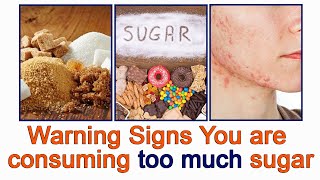 You will be shocked you have some of these signs of excess sugar consumption [upl. by Aliahs]